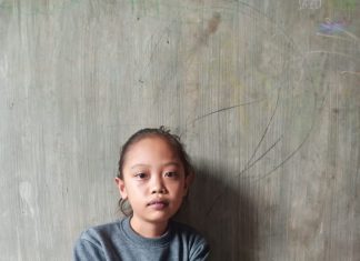 Menderita Kelainan Jantung, Sofi Harapkan Uluran Tangan Pemerintah dan Dermawan