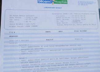 Yohan : Almarhum FS Meninggal Dunia Bukan Karena Covid-19